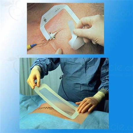 Tegaderm FILM, Plaster, transparent film, sterile. 10 cm x 12 cm - 10 bt